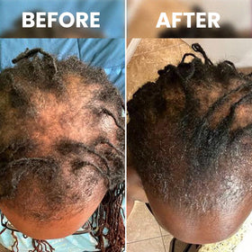Rennora Beauty before and after styling illustrating improved hair appearance