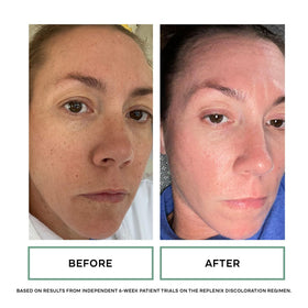 Replenix applied to hands during facial wash showing gentle use