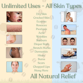 Reroot Organics applied to baby skin showing gentle, soothing benefit