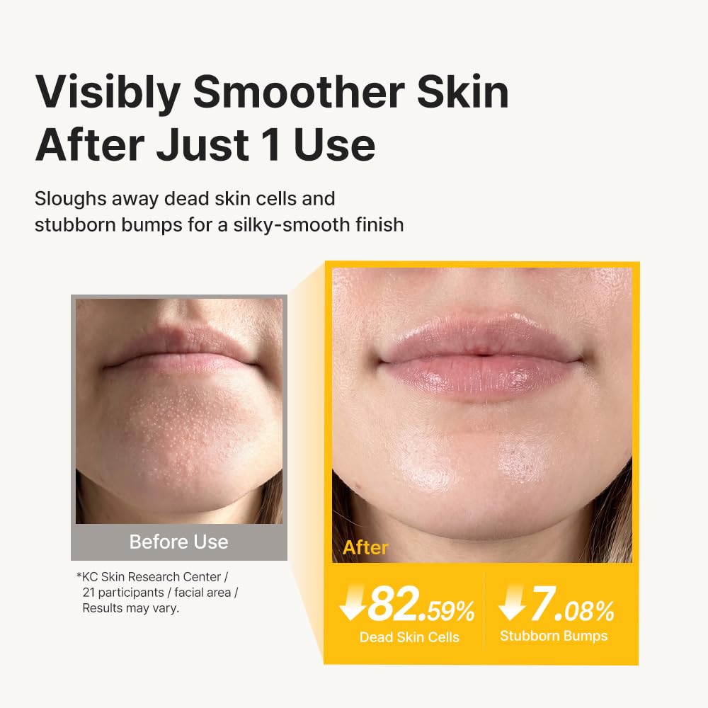 RETURNITY rinsed skin after use showing hydrated, refined, softer appearance