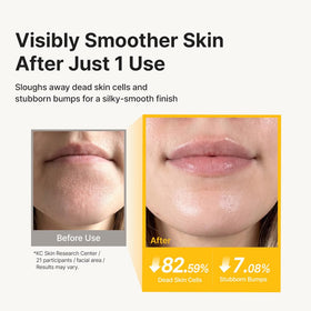 RETURNITY rinsed skin after use showing hydrated, refined, softer appearance