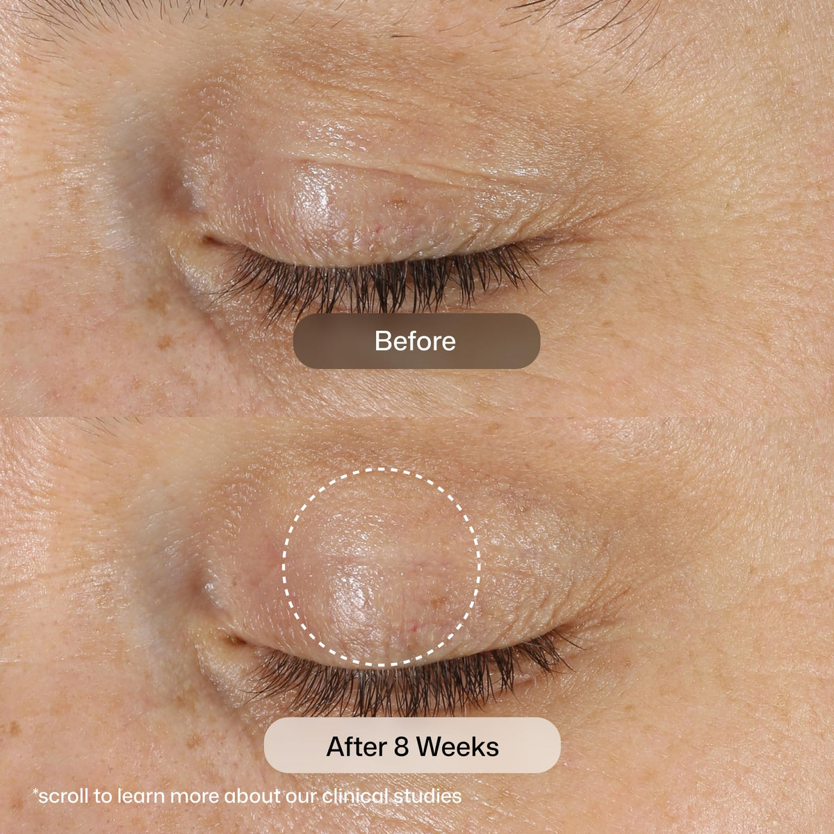 Revision Skincare D·E·J Eye Cream® being dispensed to show controlled application and gentle coverage