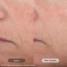 Revision Skincare pump dispensing product for controlled daily application benefit