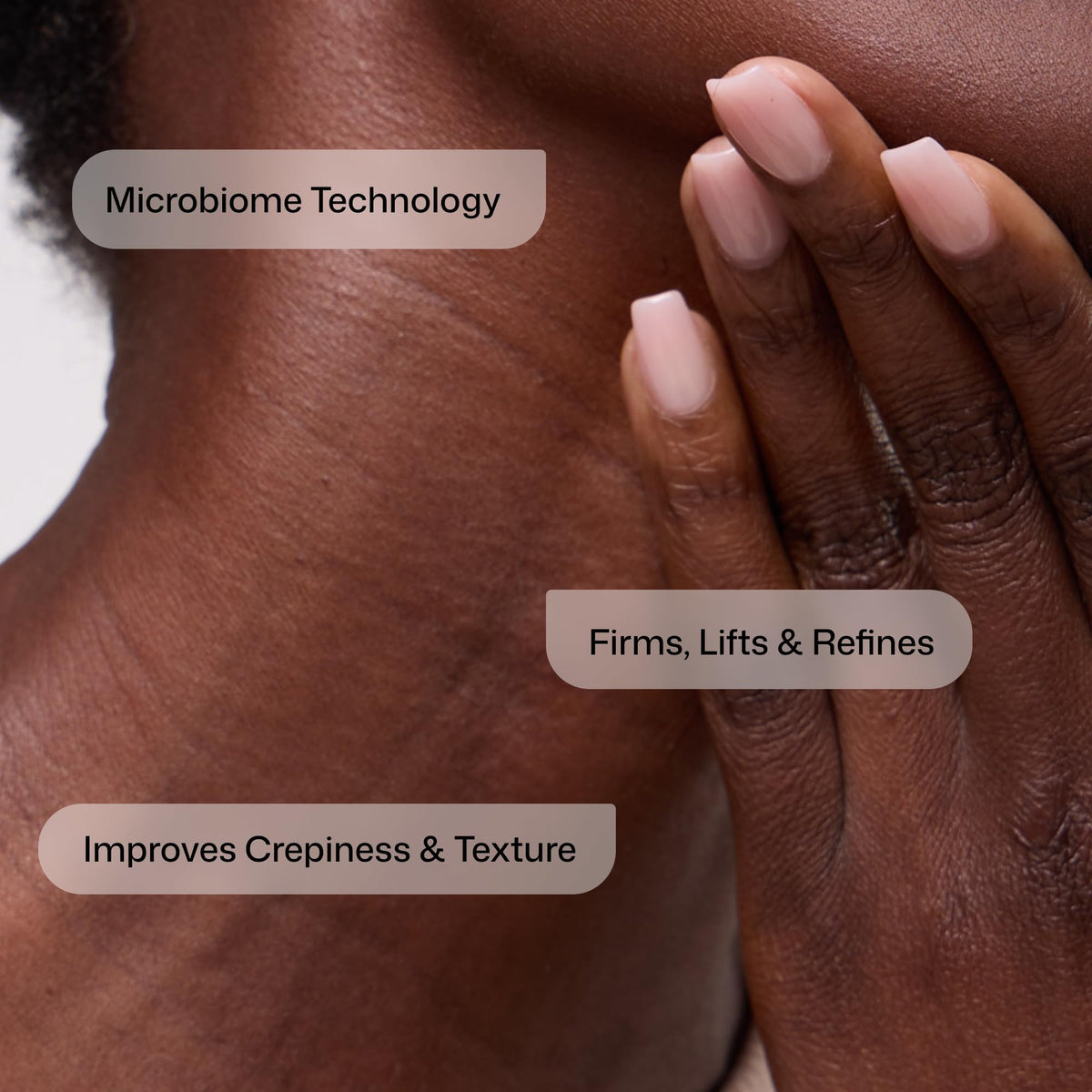 Revision Skincare Nectifirm Advanced before and after comparison showing improved contour