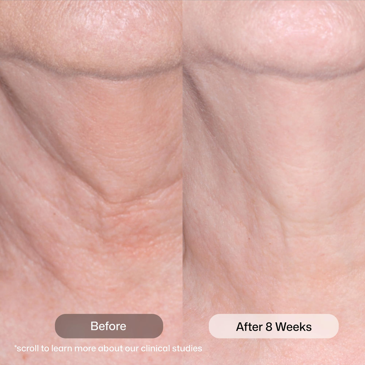 Revision Skincare Nectifirm open tube texture highlights smooth application benefit