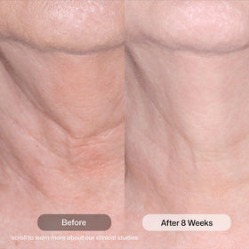 Revision Skincare Nectifirm open tube texture highlights smooth application benefit