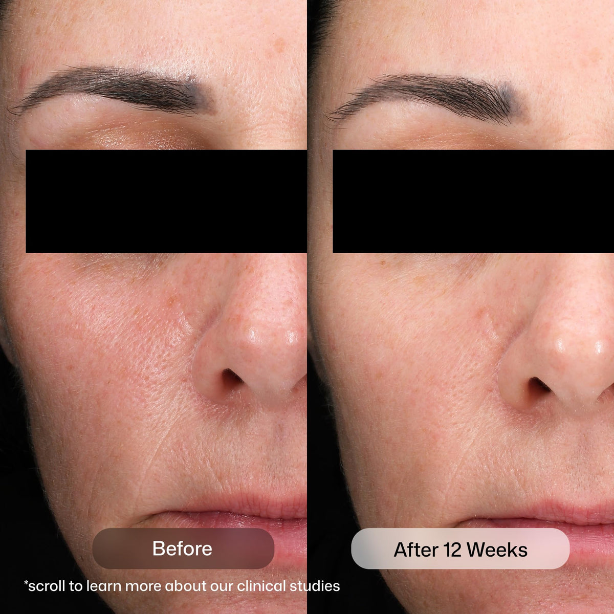 Revision Skincare serum texture on skin demonstrating lightweight absorption and finish
