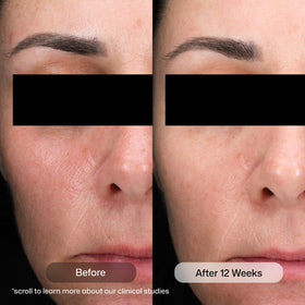 Revision Skincare serum texture on skin demonstrating lightweight absorption and finish