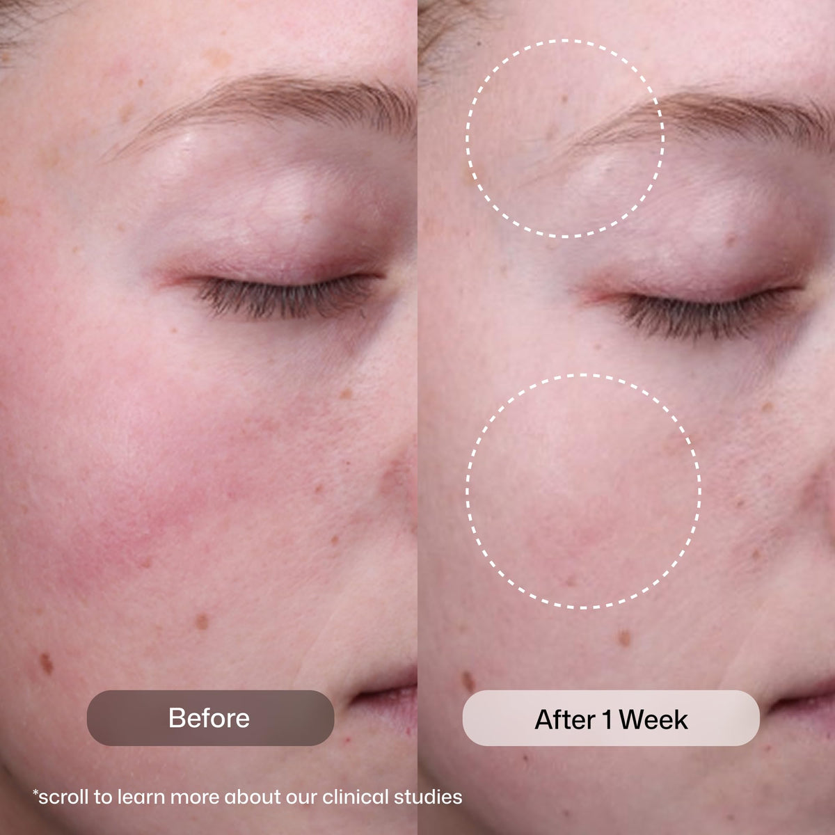 Revision Skincare pump dispenser detail for precise, mess-free pouring benefit