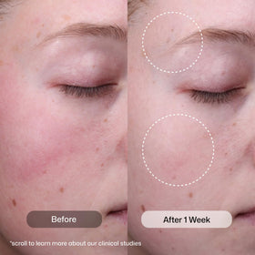 Revision Skincare pump dispenser detail for precise, mess-free pouring benefit
