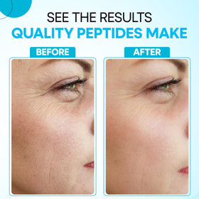 Revora serum applied to scalp, illustrating targeted scalp hydration benefit