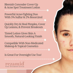 Rezamid on fingertip ready to apply, showing precise spot treatment benefit