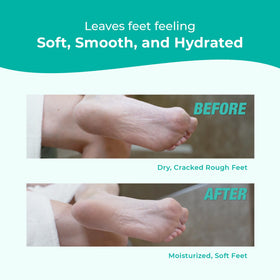 Richenna foot file with cream, illustrates tool included for effective exfoliation