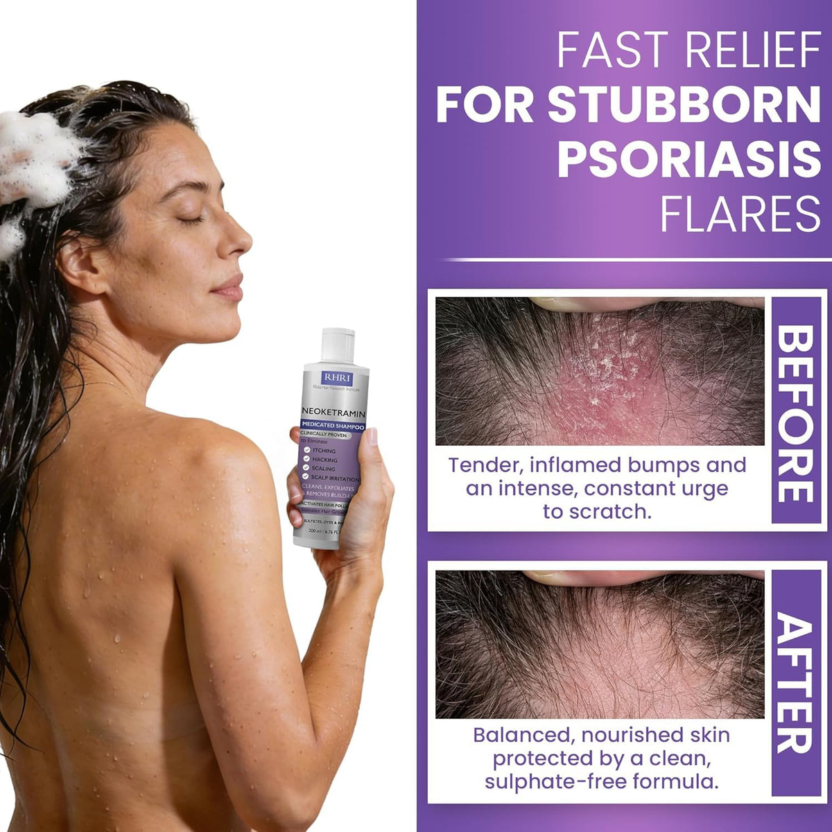 Rida Hair Research Institute applied to wet hair with brush for improved flake removal