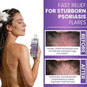 Rida Hair Research Institute applied to wet hair with brush for improved flake removal