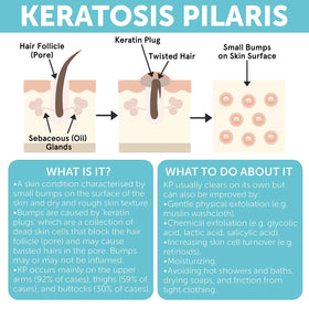 Rida Hair Research Institute applying bar to thighs to reduce bumps