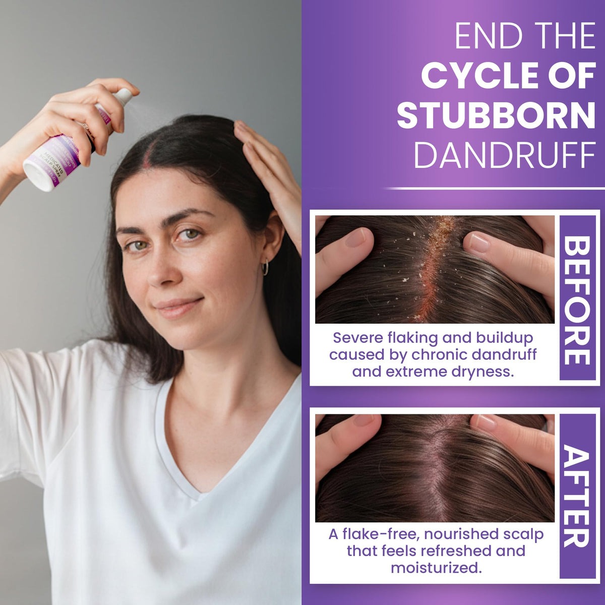 Rida Hair Research Neoketramin applied to scalp showing targeted relief and comfort