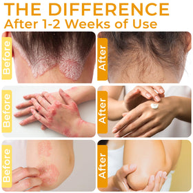 Rida Hair Research Institute applied to scalp demonstrating itch relief