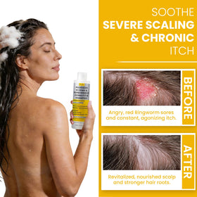 Rida Hair Research Institute applied to scalp lather showing gentle cleansing action
