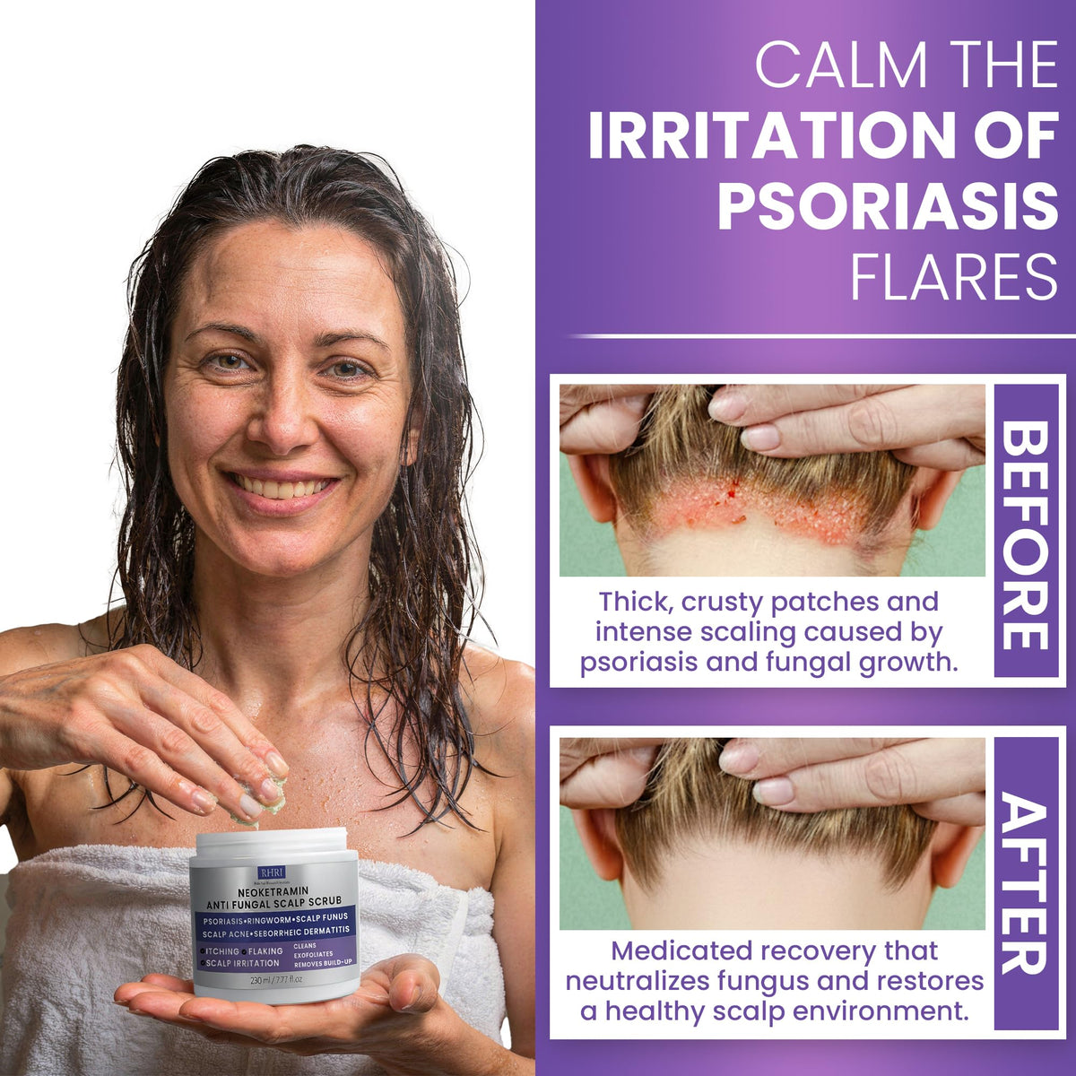 Rida Hair Research Institute scalp massage in use to show cleansing and exfoliation