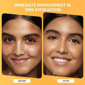 RIHAKO pumpkin ingredient bowl highlighting natural enzymes and nourishing benefit