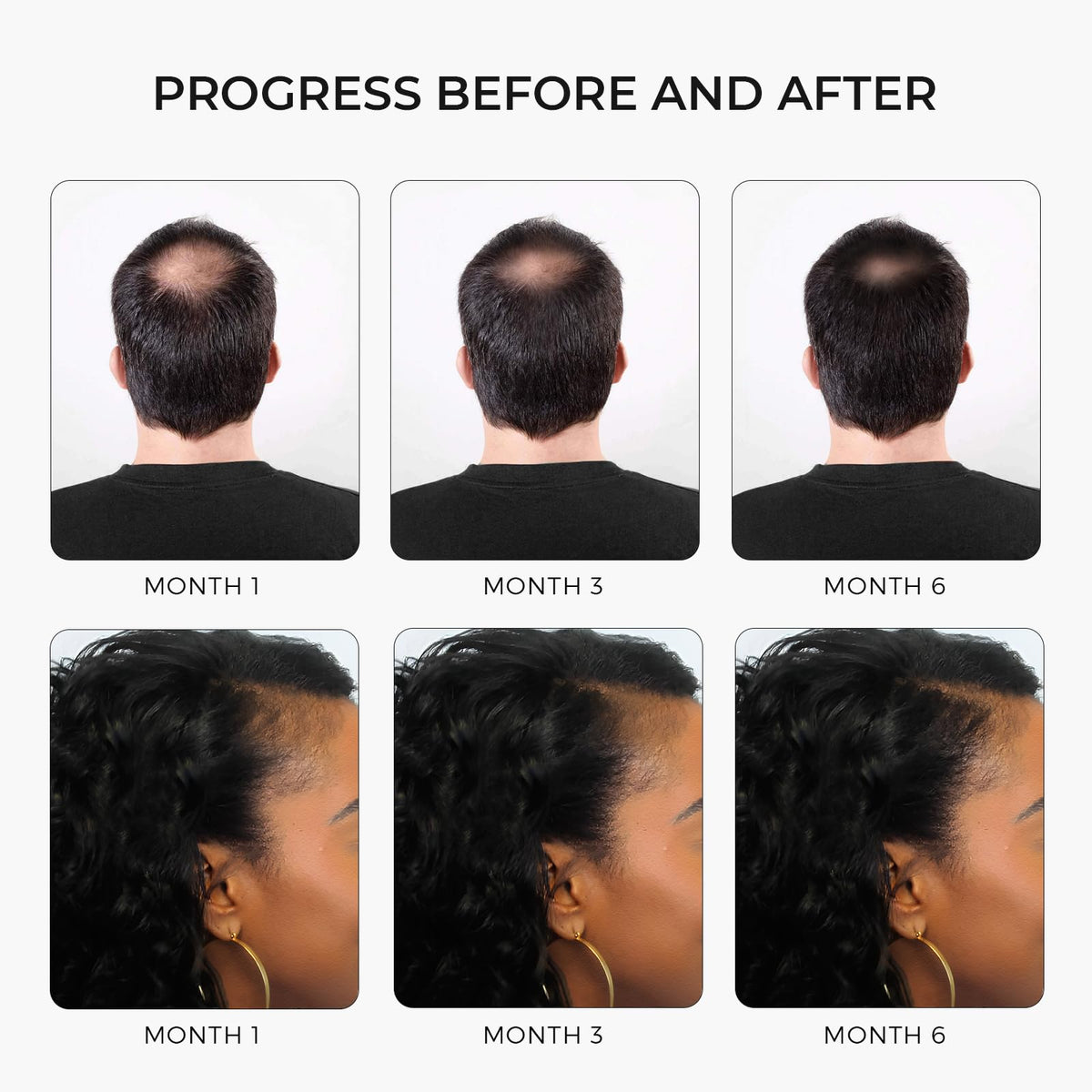 Rivermint ingredient collage with biotin, castor, saw palmetto benefits