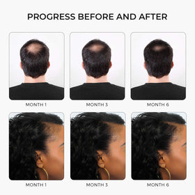 Rivermint ingredient collage with biotin, castor, saw palmetto benefits