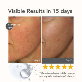 Riversol pump dispensing serum illustrating easy one-pump application benefit