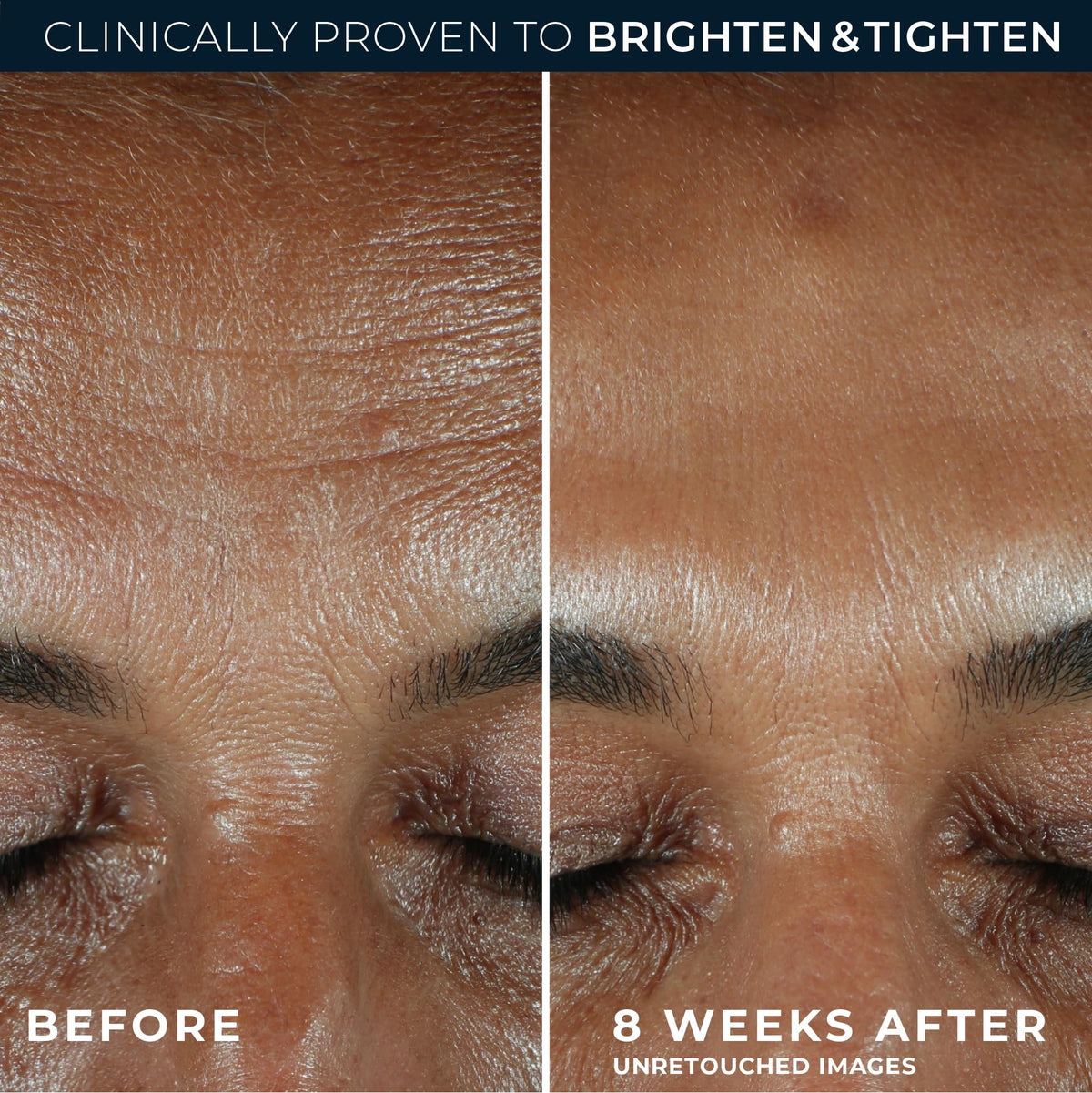 RoC applying serum to neck and face demonstrates firming and smoothing benefit