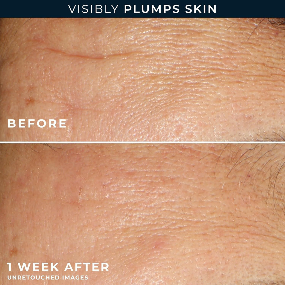 RoC opened capsule releasing serum onto fingertips, precise single-dose control