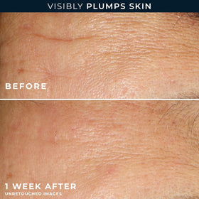 RoC opened capsule releasing serum onto fingertips, precise single-dose control