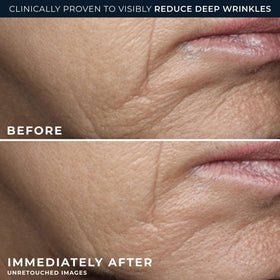 RoC bio‑ceramides ingredient visual conveying barrier restoration