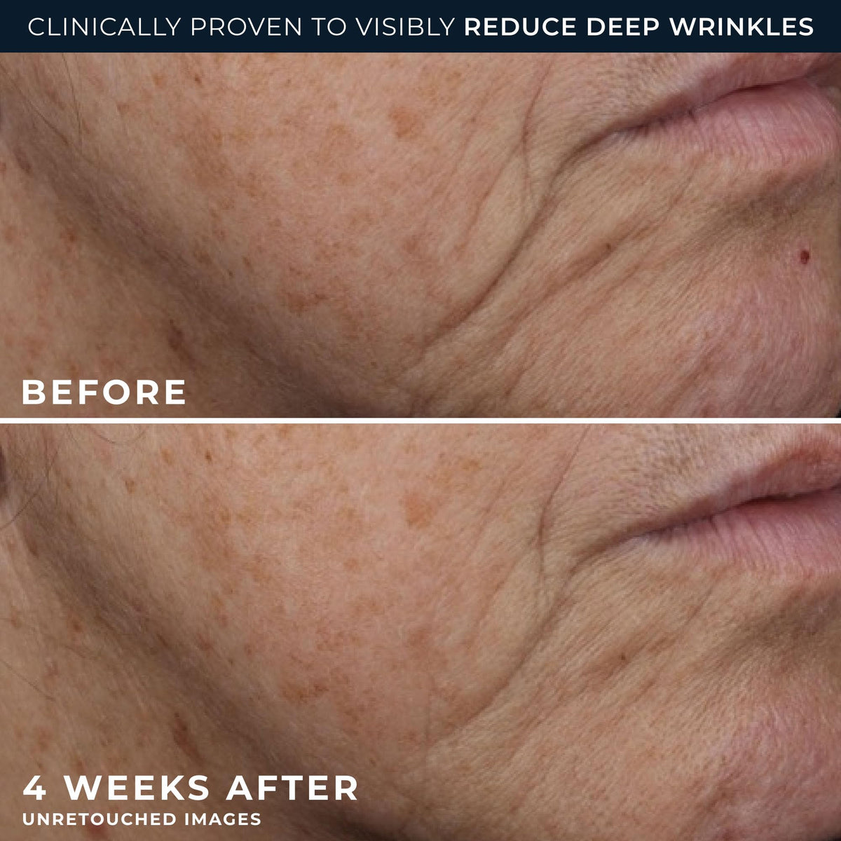 RoC patented retinol technology graphic highlighting wrinkle targeting