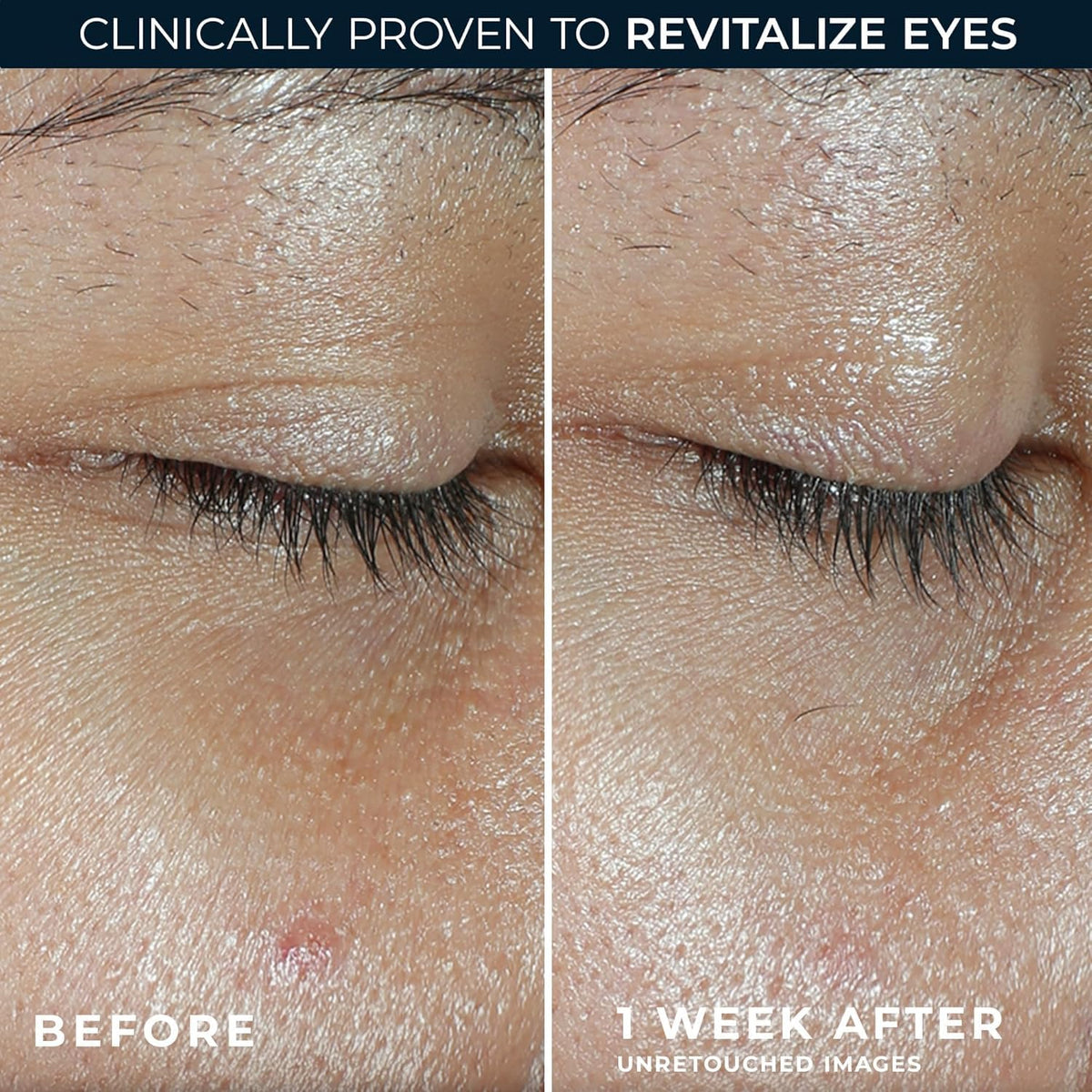 RoC balm applied under eye demonstrating refreshed, awakened look