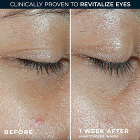 RoC balm applied under eye demonstrating refreshed, awakened look