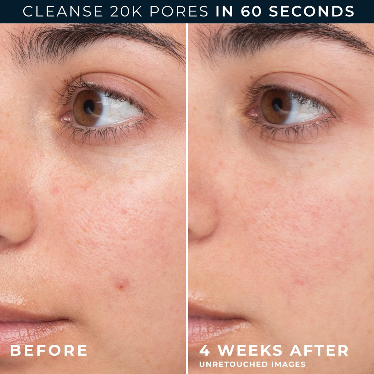 RoC foam lather on hand demonstrating gentle cleansing and light, rinseable foam