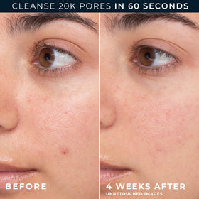RoC foam lather on hand demonstrating gentle cleansing and light, rinseable foam