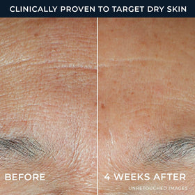 RoC close-up of milky serum texture demonstrating fast absorption