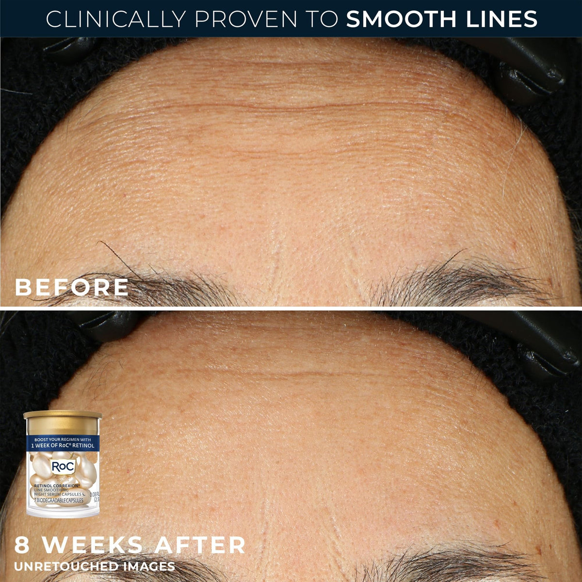 RoC ingredient visual displaying retinol hyaluronic acid ceramides and targeted renewal benefit