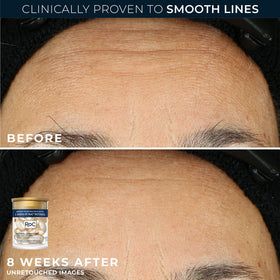RoC ingredient visual displaying retinol hyaluronic acid ceramides and targeted renewal benefit