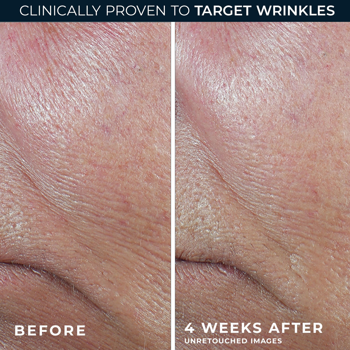 RoC product label highlighting retinol and antioxidant blend