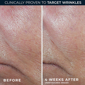 RoC product label highlighting retinol and antioxidant blend
