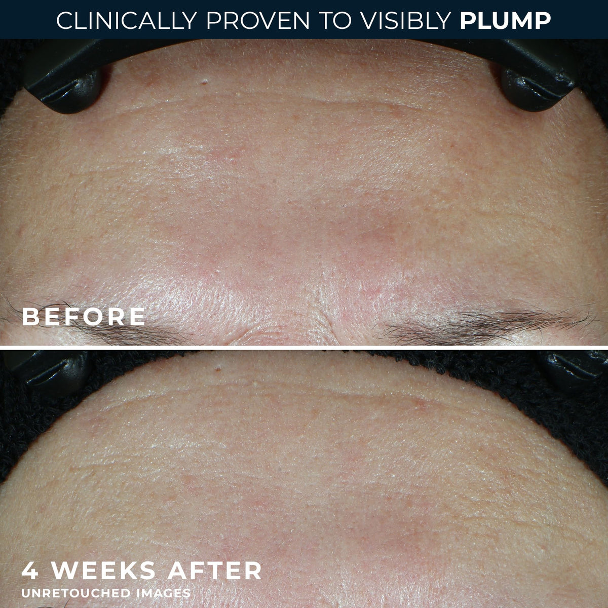 RoC cream being applied to cheek demonstrating quick absorption