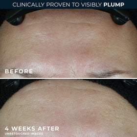 RoC cream being applied to cheek demonstrating quick absorption