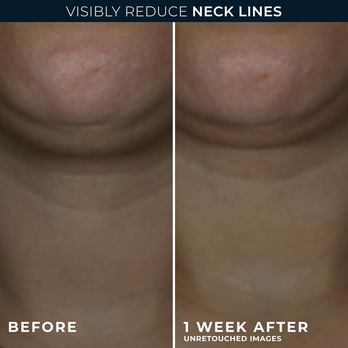 RoC neck cream open jar texture highlighting hydrating gel-cream