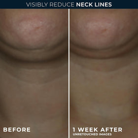 RoC neck cream open jar texture highlighting hydrating gel-cream