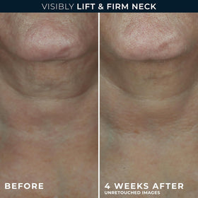 RoC neck cream dispensed amount on fingertip for proper dosing