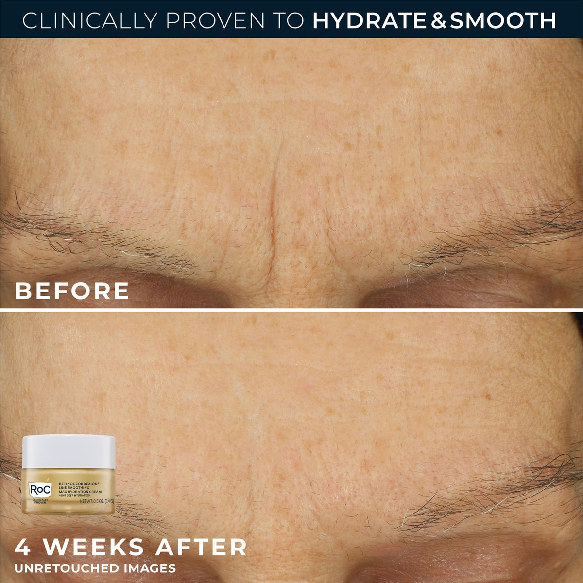 RoC products arranged on a vanity illustrating routine use and streamlined skincare benefit