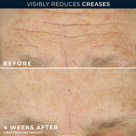 RoC retinol capsule open to show single measured retinol dose