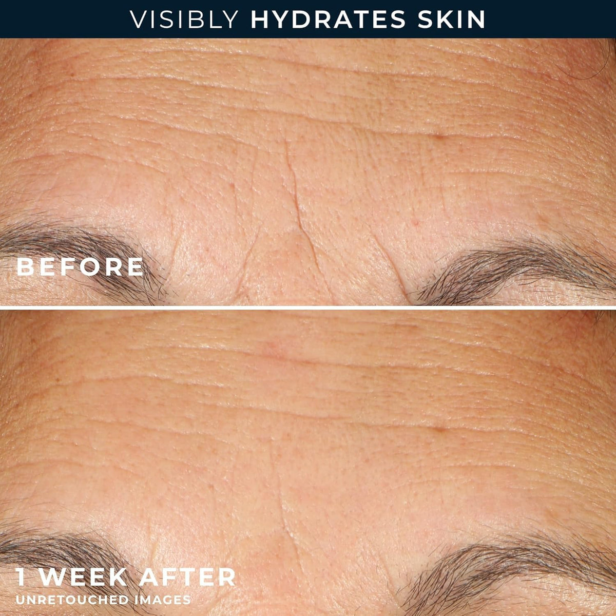 RoC retinol capsules seven-count trial pack visible, supports trial convenience